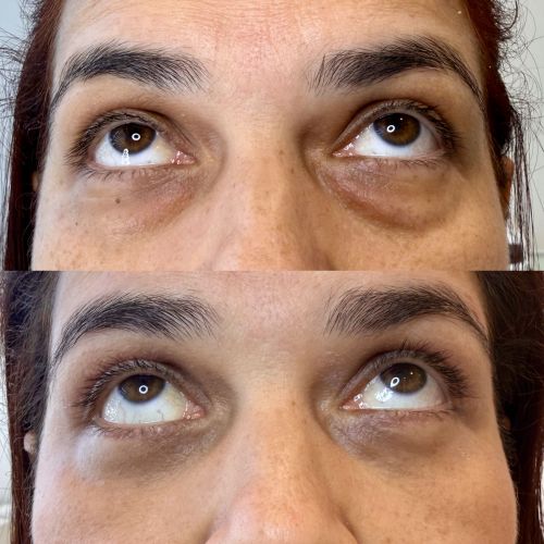 Cirugia Dermatologica
